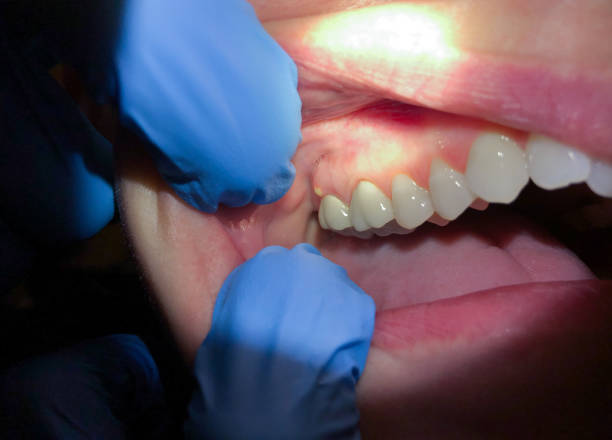  Pottsville, AR Emergency Dentist Pros