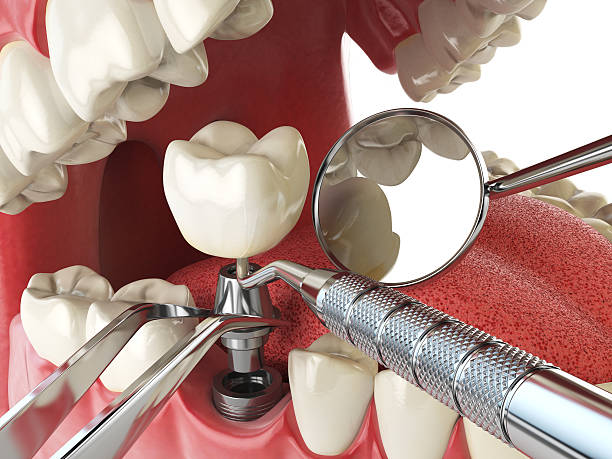 Best Emergency Treatment for Toothache in Pottsville, AR